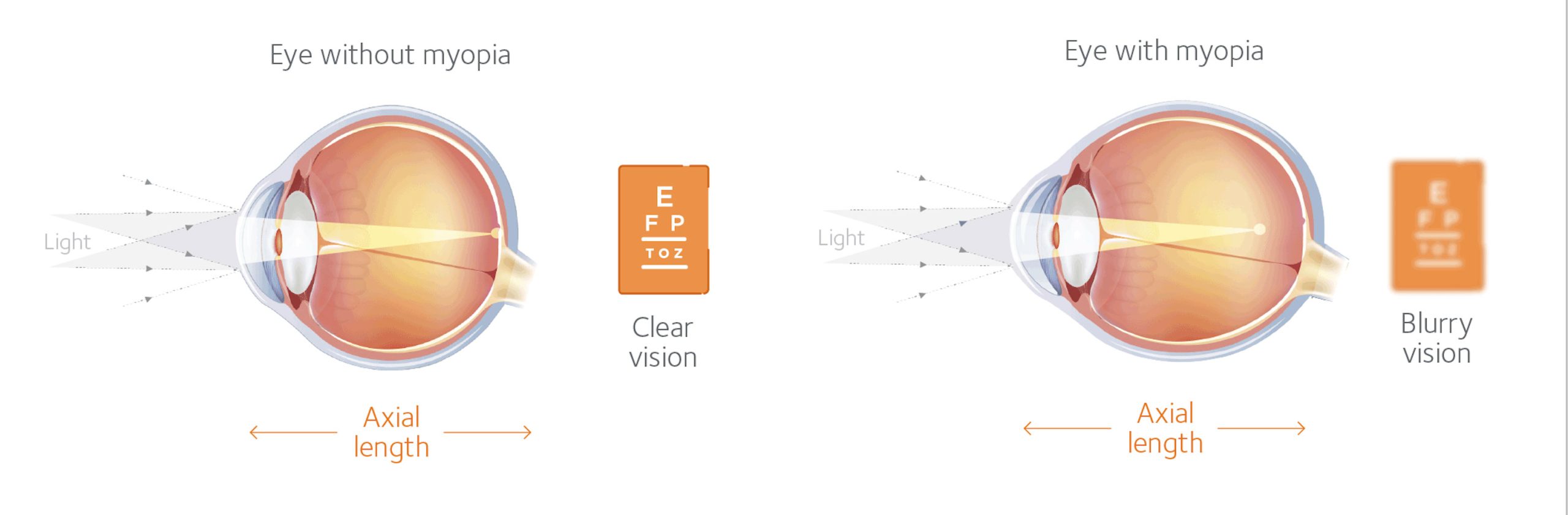 Ray-Ban Meta - AI Glasses